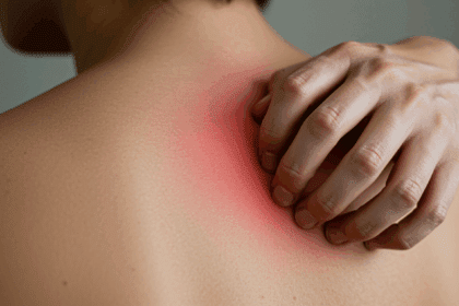 Beta-Alanine Itch​